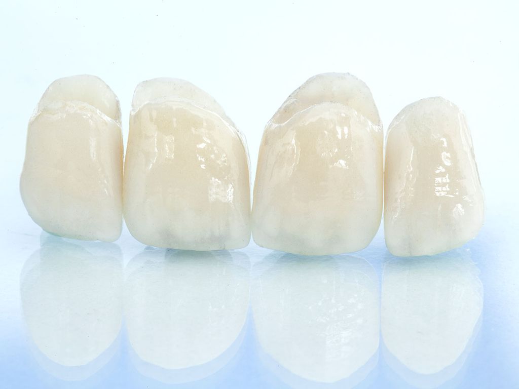 ジルコニアクラウン