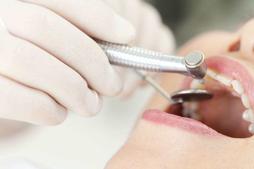 むし歯・歯周病などの治療