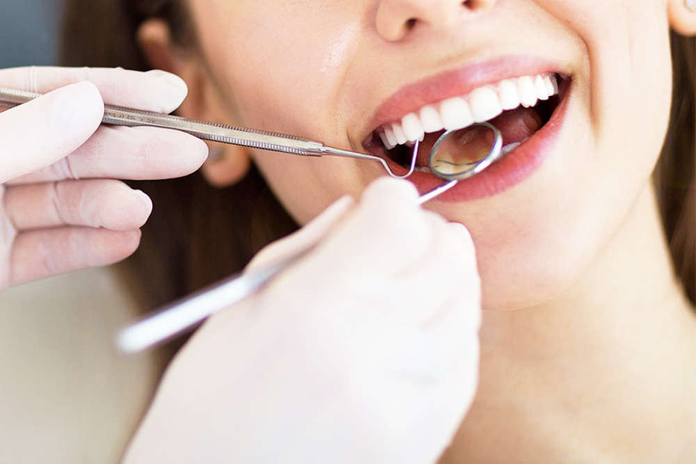 クリーニング・口腔ケア